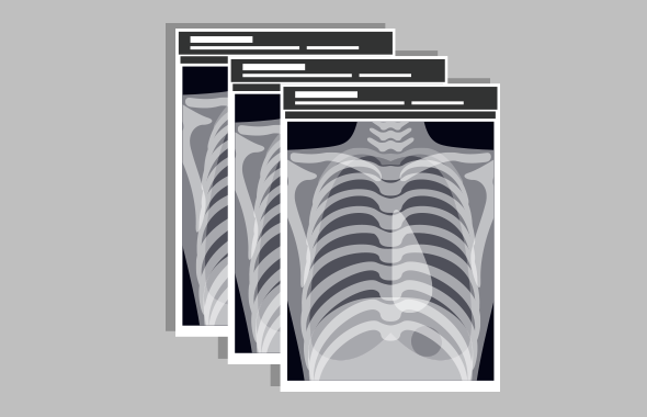 レントゲンフィルム電子化
